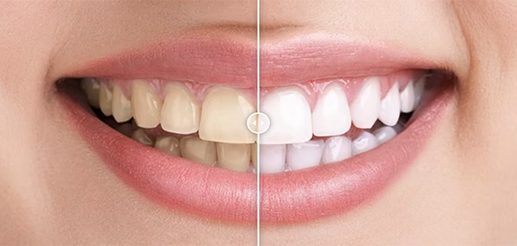 Item cover for download Before & After Images Comparison WordPress Plugin